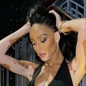 Winnie Harlow